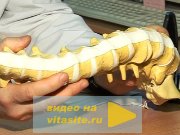 Нестабильность в шейном отделе позвоночника