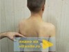 Сколиоз и нарушение осанки
