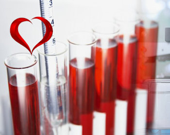 Работа сердца и биохимический анализ крови thumbnail