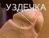 уздечка полового члена