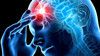 cerebrolizin1.jpg
