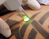 lazer-udalenie-tatu.jpg