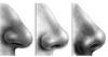 nose-p08.jpg