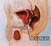 prostata-encl.jpg
