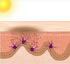 skin-sun.jpg