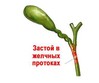 zastoj-v-zhelchnyx-protokax.jpg